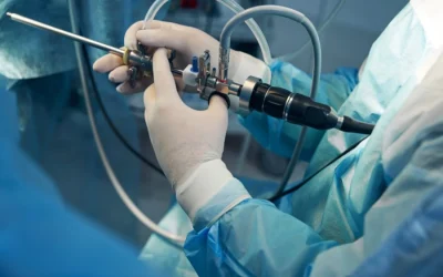 ¿Qué es la Cistoscopia? Todo lo que Necesitas Saber sobre este Procedimiento Urológico